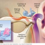 what-causes-ringing-in-the-ears-ear-problems