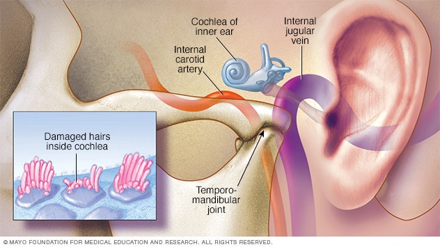 what-causes-ringing-in-the-ears-ear-problems