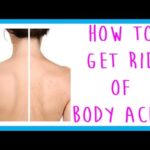 faq-how-to-get-rid-of-body-acne-back-acne-chest-acne-leg-acne-arm-acne