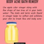 how-to-cure-body-acne-naturally